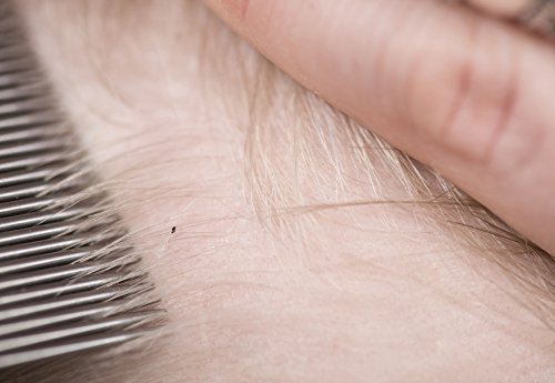 Basic Needs Lice Comb Set - Perfect Hair and Scalp Lice Treatment Care Kit Product - Use with or Without Shampoo and Rinse -For Adults, Kids and Baby - Thumbnail 6
