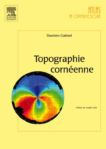 Topographie cornéenne