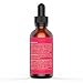 Best Organic Rosehip Oil for Face, Dry Skin, Hair & Stretch Marks - Gio Naturals Premium Grade is Pure Unrefined & Cold Pressed -Works Best On Eliminating Dark Spots, Wrinkles, Fine Lines & More!
