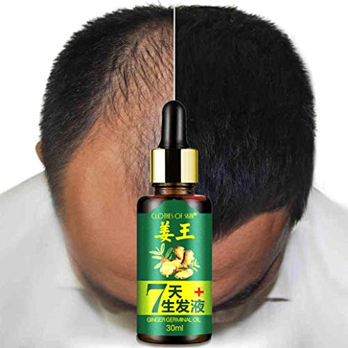 Hair Growth Essence,Lovewe Hair Growth Essence liquid,FastHair Growth,Natural Hair Loss Treatment
