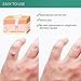BEALUZ Wart Remover Fast Acting Gel- Effectively Remove Flat Warts, Plantar Warts, Common Warts, Corn, Callus-Painlessly,Easy to Absorbthumb 4