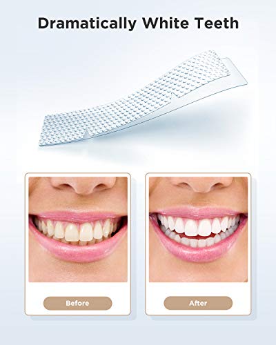 Fairywill Teeth Whitening Strips for Sensitive Teeth - Reduced Sensitivity Whitener strips, Gentle and Safe for Enamel, 3D Whitestrips Pack of 28 White Strips