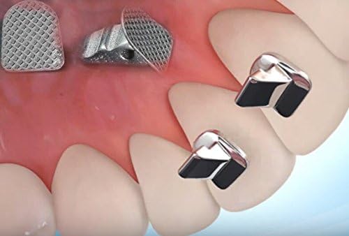 Lot of 10, smileortho® Mite Turbos (Base Mesh Polished with Sandblasting) for the treatment of Orthodontic Dental Dentist Orthodontics, Bite Turbos (Sandblasted Mesh Base) for Dental Orthodontics Treatment Orthodontist Dentist