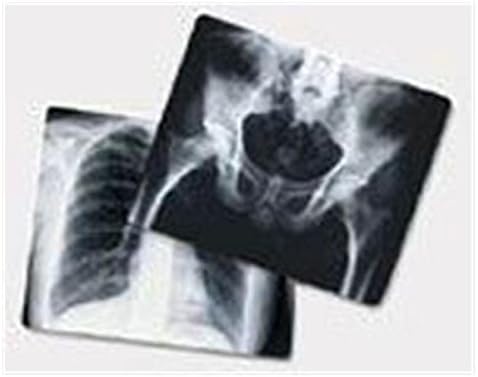 WP000-PT -EBA6A EBA6A X-Ray Film Blue 800 Speed 10x12 100/Bx Agfa Corporation