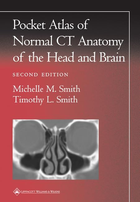 Atlas of Nuclear Cardiology: Imaging Companion to Braunwald's