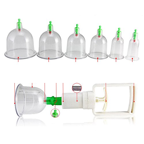 Contever® 6 Cups Traditional Chinese Medical Vacuum Body Cupping Device Cure Therapy Set