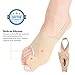 Bunion Corrector Big Toe - Bunion Splints Pain Relief - Hallux Valgus Treatment Kit Protector - Bunions Pads Toe Spacer for Women & Men (S Size(5-7.5))