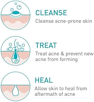 cerave acne foaming cream cleanser benzoyl peroxide