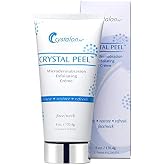 Crystal Peel Microdermabrasion Exfoliating Face Cr&egrave;me &ndash; Medical-Grade Anti-Aging Facial Scrub to Reduce Fine Lines, Wrinkles, Discoloration &amp; Acne Scars, Professional Resurfacing Treatment, 6oz
