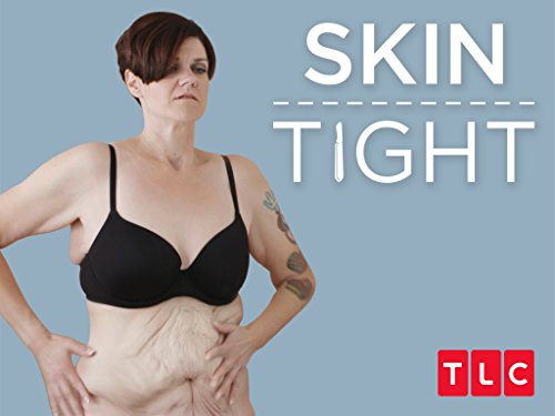 My 600-lb Life: Skin Tight Season 2
