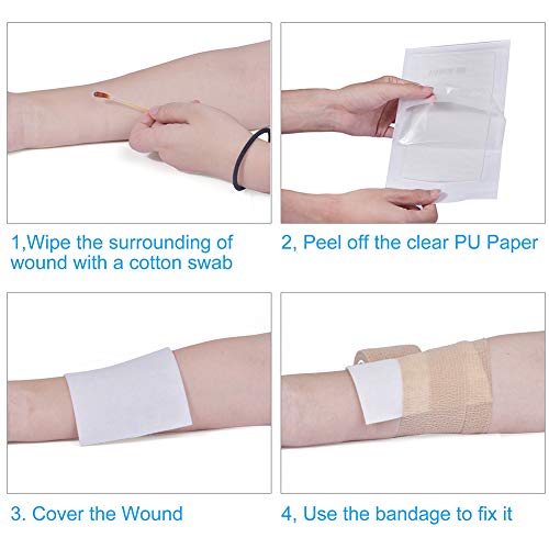 10 Count Calcium Alginate Wound Dressing Pads, 4”x8”, NonStick Padding