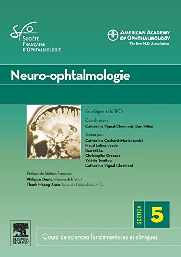 Neuro-ophtamologie