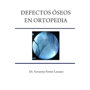 Defectos oseos en Ortopedia (Spanish Edition)
