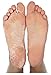 4 oz Callus Remover, with pumice stone. Callus Eliminator,Liquid & Gel For Corn And Callus On Feet. Professional Grade