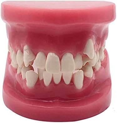 Amazon Co Jp 歯列矯正歯モデル シミュレーション口腔歯タイポドン歯モデル 歯のケア教育研究デモンストレーションモデル ラボ教育研究研究ツール用 ホーム キッチン