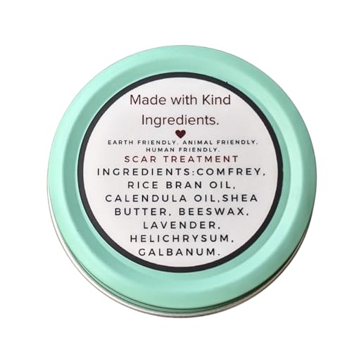 SSF Organics Scar Treatment for Stretch Marks, C-Section Recovery Must Have- Deeply Moisturize with Calendula, Castor, Shea - Advanced Scar Treatment for Mama Related Wounds