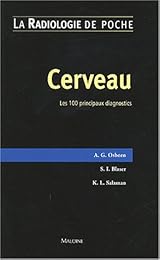 Cerveau