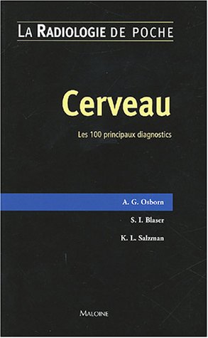 Cerveau