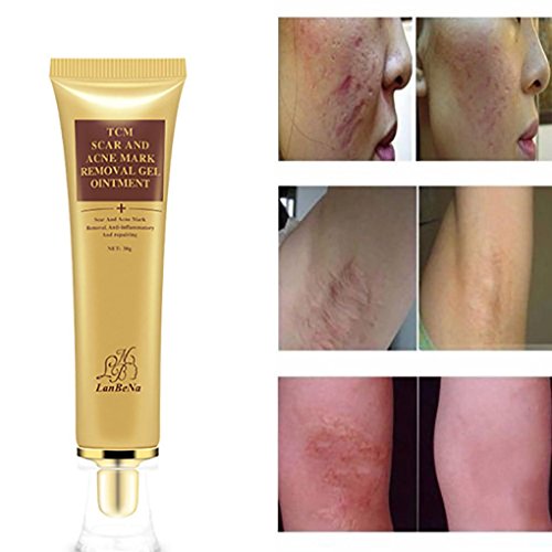 Hometom Scar Removal Gel Skin Repair Cream Acne Spot Treatment Reduces The Old & New Scars (Yellow)