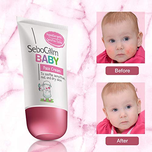 SeboCalm Baby Face Cream Lotion Hypoallergenic Vegan Facial