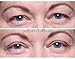 EasyLift The Original 60 Second Eye Lift | As Seen On TV | Lab Tested For Save Everyday Use | Made In the USA
