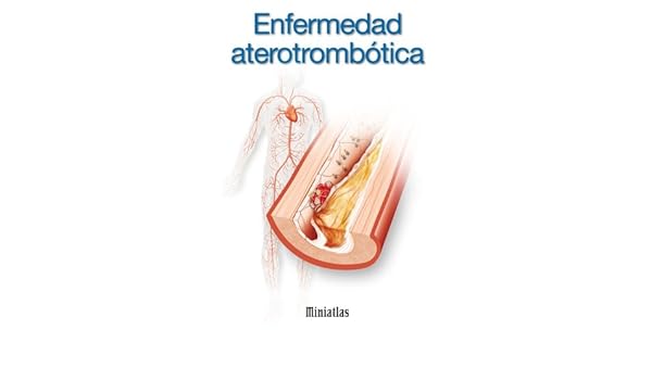 The joint diseases miniatlas english edition