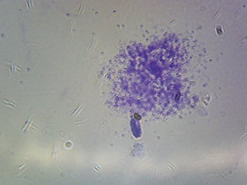 Cocci Spherical Bacteria, Staphylococcus Aureus - Microscope Slide