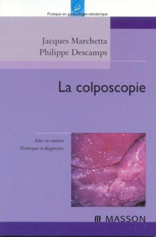 La  colposcopie
