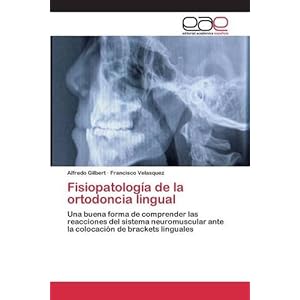 Fisiopatología de la ortodoncia lingual (Spanish Edition)