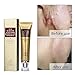 Amareu Acne Scar Removal Cream Skin Repair Face Cream For Burns Cuts Operation Stretch Mark Remover Acne Scars Treatment