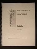 Intraoperative Monitoring : Eeg, American Journal of Electroneurodiagnostic Technology Staff, 1577970519