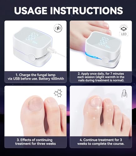 Next-Gen Nail Fungus Laser Device【21-day Fast-acting】Antifungal Laser【Kaltlicht-Technologie - Wohltuend mild】 PainFree Device With Time Display & Yellow Cuticle Oil Pen