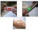 SG-7D Skin Moisture Analyzer Face Care Portable Advanced Version White by SG