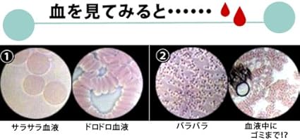 Amazon 小型カード顕微鏡 顕微球 顕微鏡