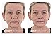My Perfect Facial – Travel Size Skin Care Set | At-Home Anti-Aging Treatment | Instant Face Lift, Firming & Toning | Reduces Fine Lines, Wrinkles, Pores & Skin Discoloration (5 Treatments)