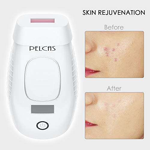 IPL Hair Removal System,PELCAS 600,000 Flashes Light Hair Removal Device Permanent Professional Full Body Hair Removal Epilator, 2 in 1 Functions Strengthen Version for Home Use - Thumbnail 2