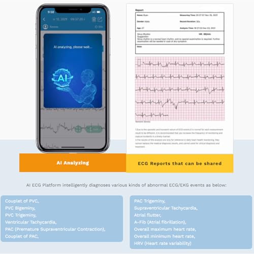 CheckMe Armfit Plus Arm Blood Pressure Monitor with ECG and ECG Report Analysis, Automatic Measurement in 30S, Free APP for Android and iOS, with Multi-User Management and Unlimited Storage