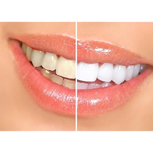 Beauty & Personal Care, Oral Care, Teeth Whitening