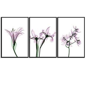 signwin Framed Canvas Wall Art X-Ray Flowers Canvas...