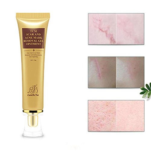 Hometom Scar Removal Gel Skin Repair Cream Acne Spot Treatment Reduces The Old & New Scars (Yellow) - Thumbnail 5