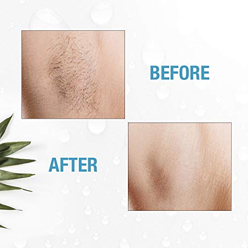 Clean + Easy NonLaser Personal Electrolysis for Face and Body, Permanent Hair Removal Battery