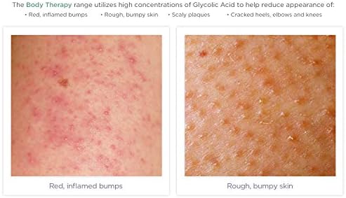 nu skin cellulite cream