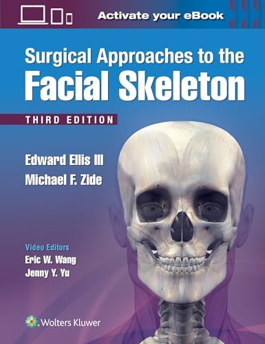 Local Flaps in Facial Reconstruction: 9781455753161: Medicine