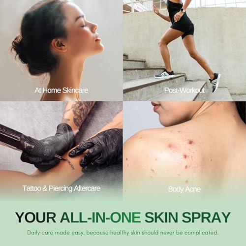 BIONA Pure Hypochlorous Acid Spray 0.018%, pH-Balanced for Face & Skin | Calming, Soothing Natural Cleanser for Acne-Prone Skin, Eczema, Irritation, Redness, Baby Rashes, Eyelid & Lash Care | Safe for All Ages & All Skin Types - 8oz/236ml