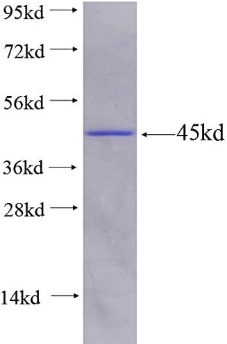 Human GK Fusion Protein