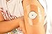 No-Hole 25-Pack Freestyle Libre, Enlite, Medtronic Guardian Adhesive Patches, Pre Cut Waterproof CGM Patches, Hypoallergenic Medical Tape, Continuous Glucose Monitor Protection Stickers for Diabetics