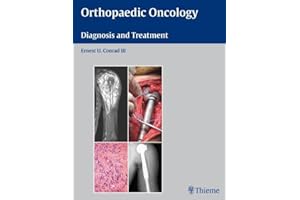 Orthopaedic Oncology: Diagnosis and Treatment