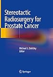 Stereotactic Radiosurgery for Prostate Cancer