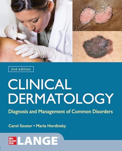 Differential Diagnosis of Common Complaints: 9780323512329