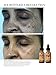 Vivant Skin Care Bleaching Cream, 1 Ounce